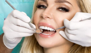 Everything to Know About Veneers Treatment in Peabody