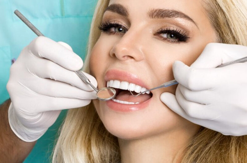 Everything to Know About Veneers Treatment in Peabody