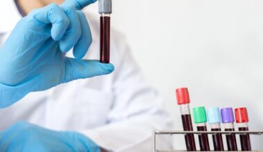 Can You Have Tuberculosis Without Symptoms Understanding TB Screening