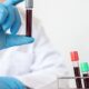 Can You Have Tuberculosis Without Symptoms Understanding TB Screening