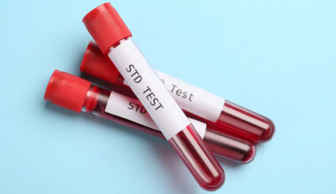 When to Get Tested After Sexual Exposure