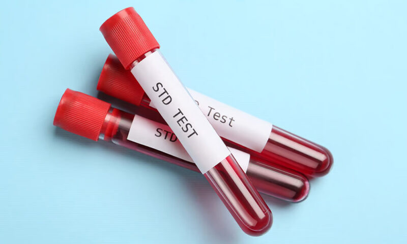 When to Get Tested After Sexual Exposure