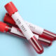When to Get Tested After Sexual Exposure